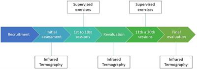 Feasibility for Using Thermography Throughout an Exercise Program in Mastectomized Patients